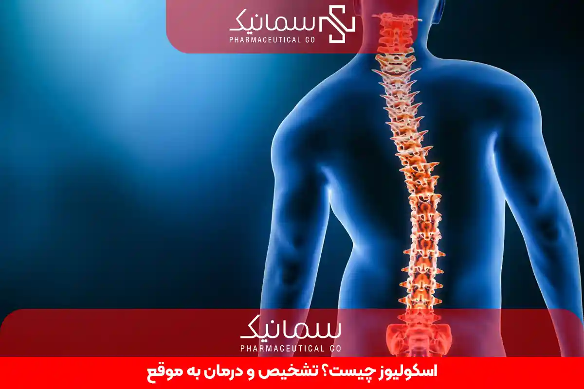 اسکولیوز