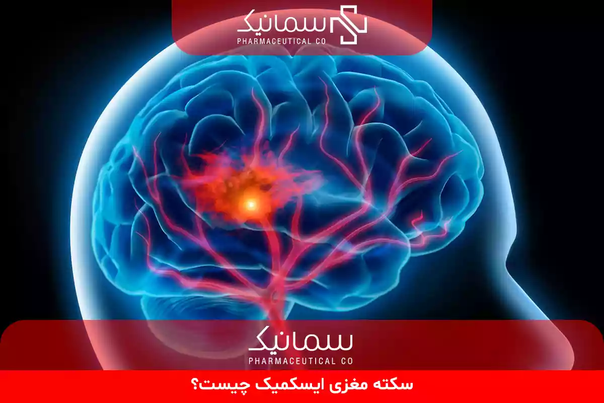سکته مغزی ایسکمیک