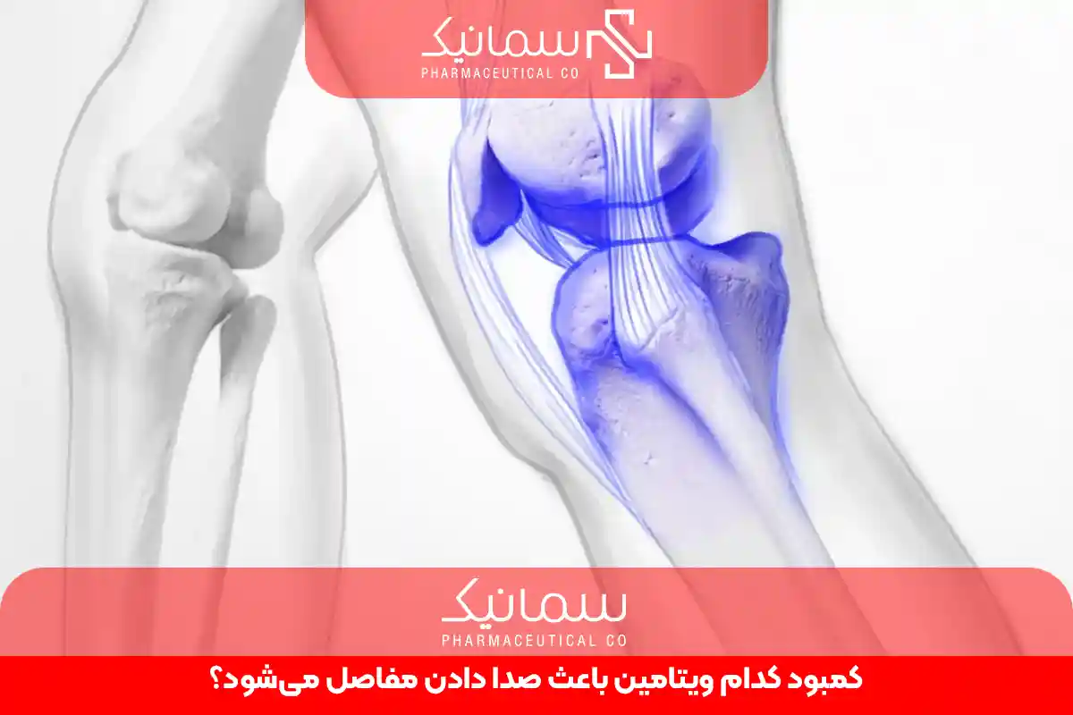 کمبود کدام ویتامین باعث صدا دادن مفاصل