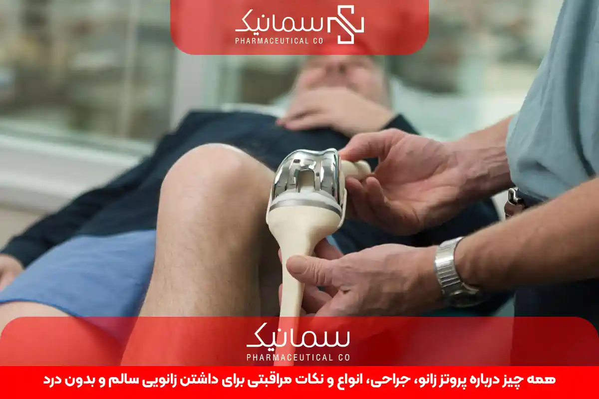 پروتز زانو
