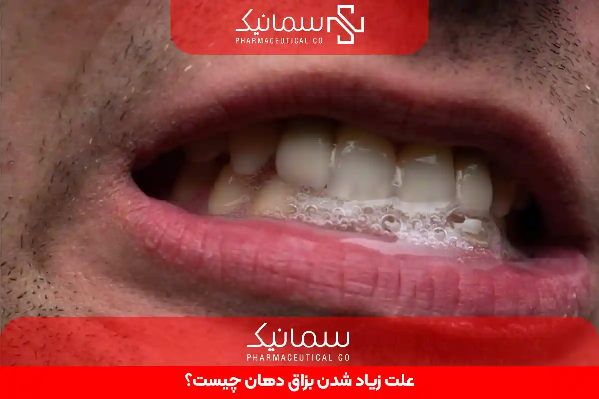 زیاد شدن بزاق دهان