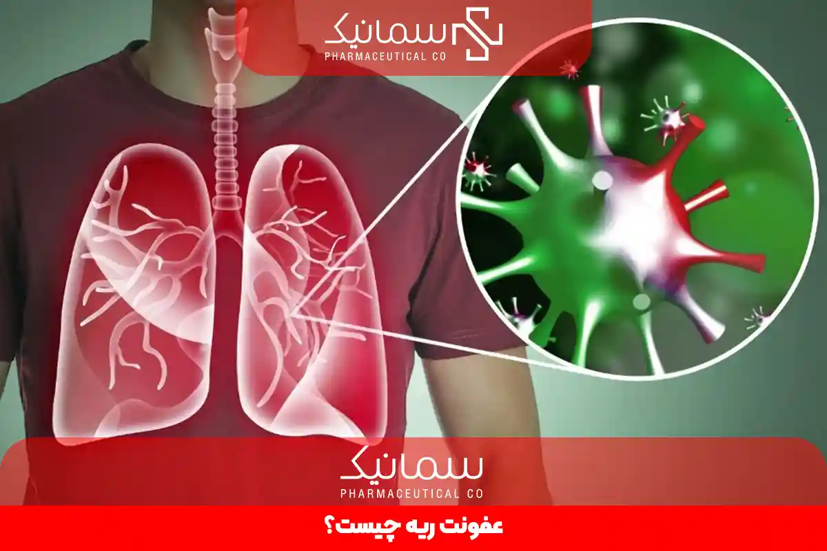 عفونت ریه