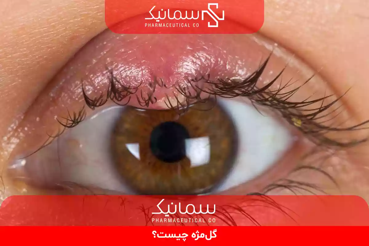 گل‌مژه