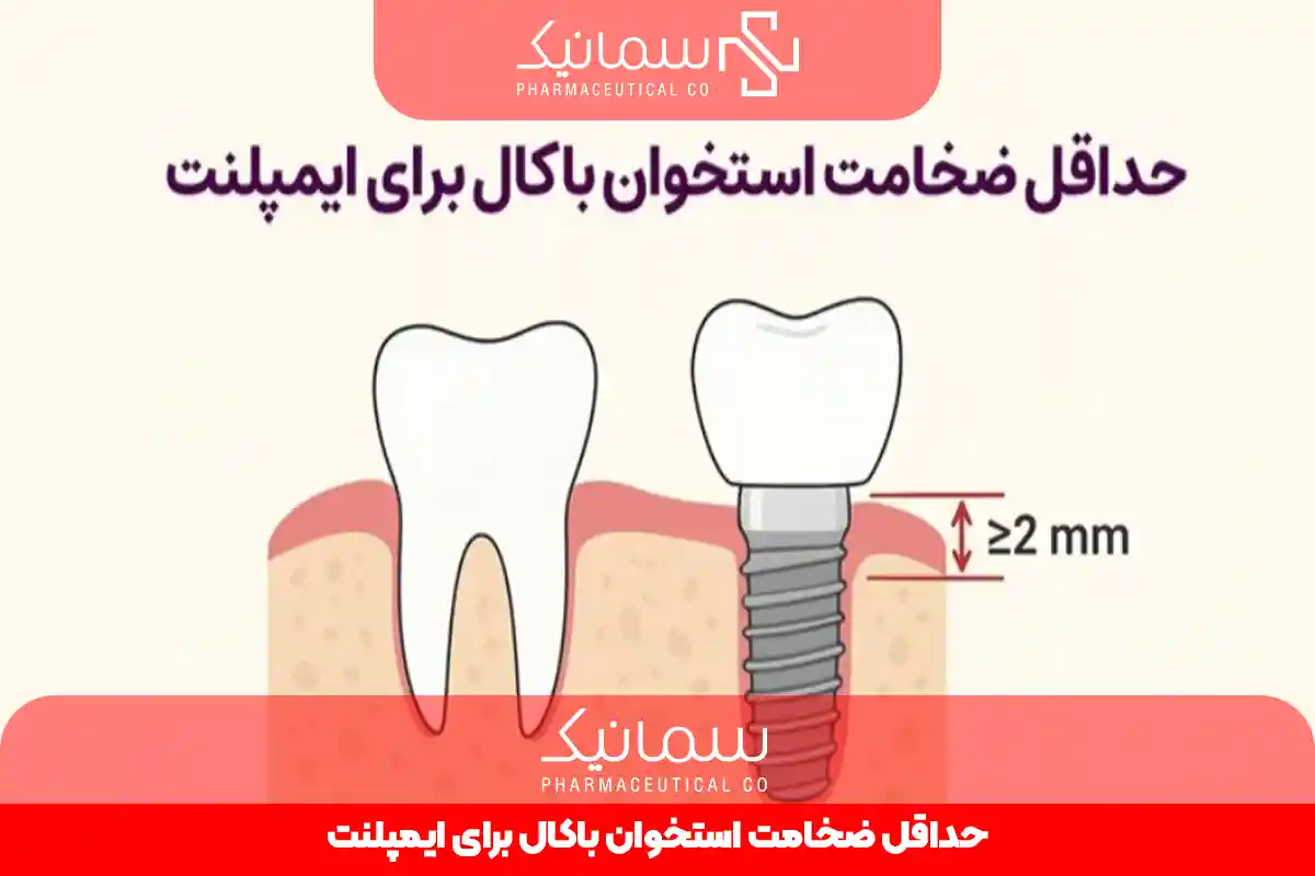 حداقل ضخامت استخوان باکال برای ایمپلنت
