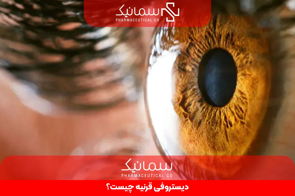 دیستروفی قرنیه چیست؟