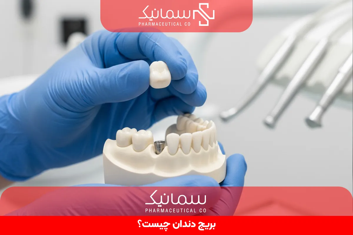 بریج دندان چیست؟