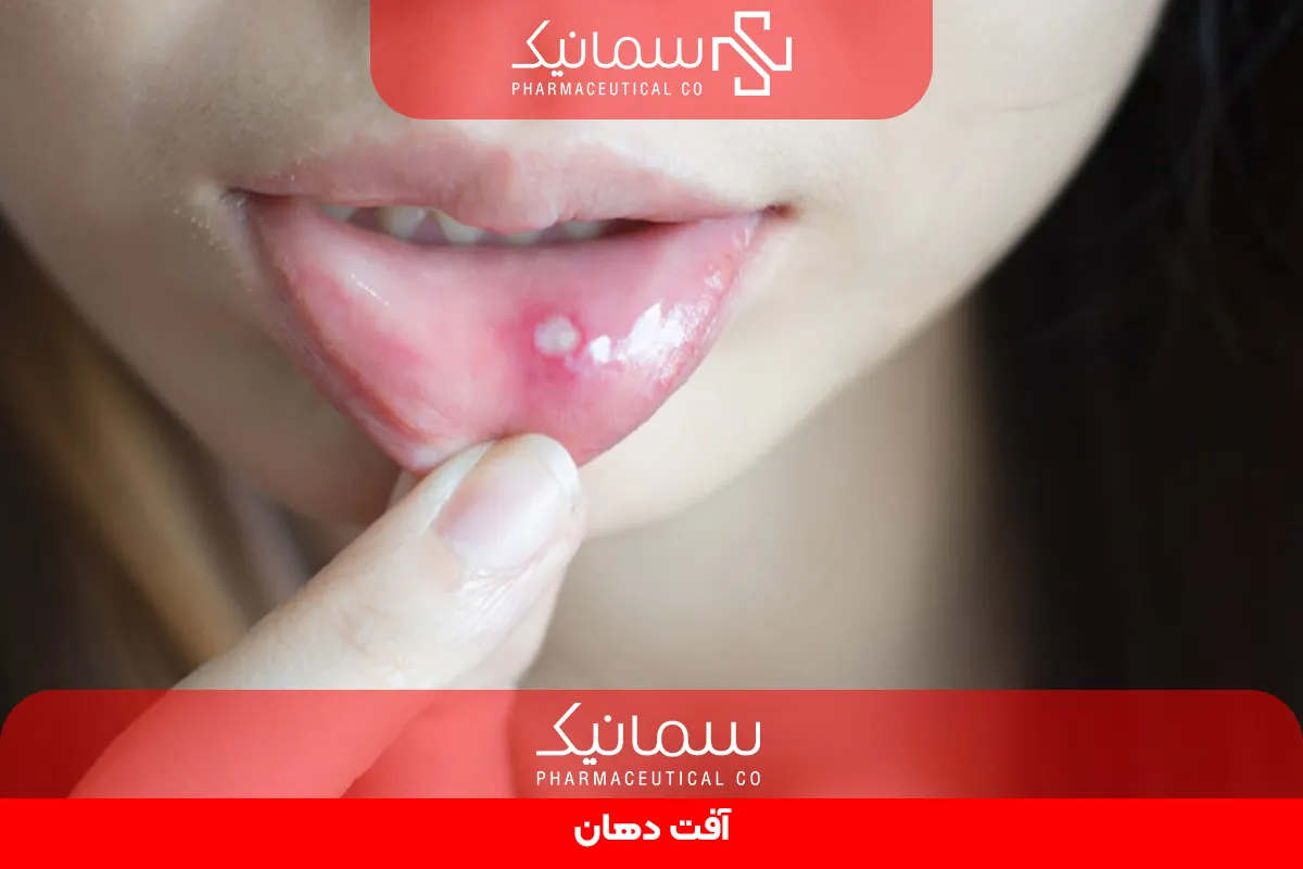 آفت دهان