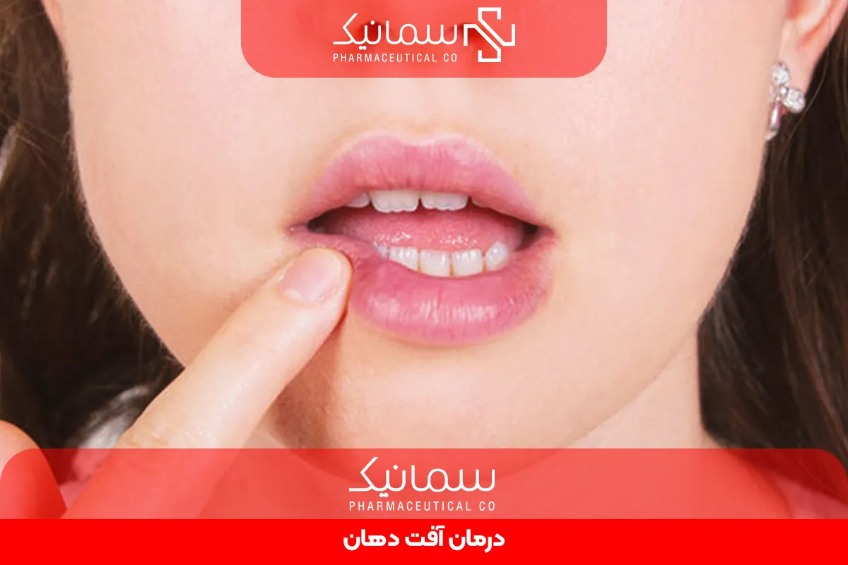 درمان آفت دهان