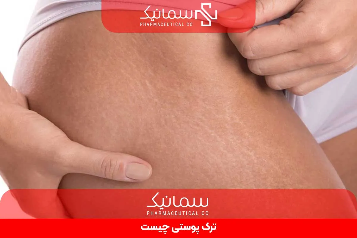ترک پوستی چیست
