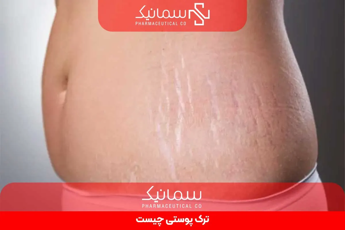 ترک پوستی چیست