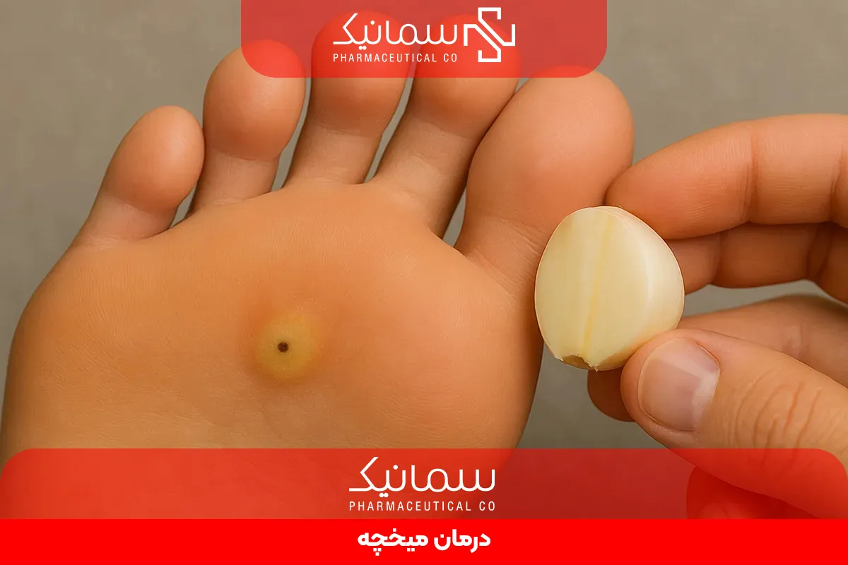 درمان میخچه