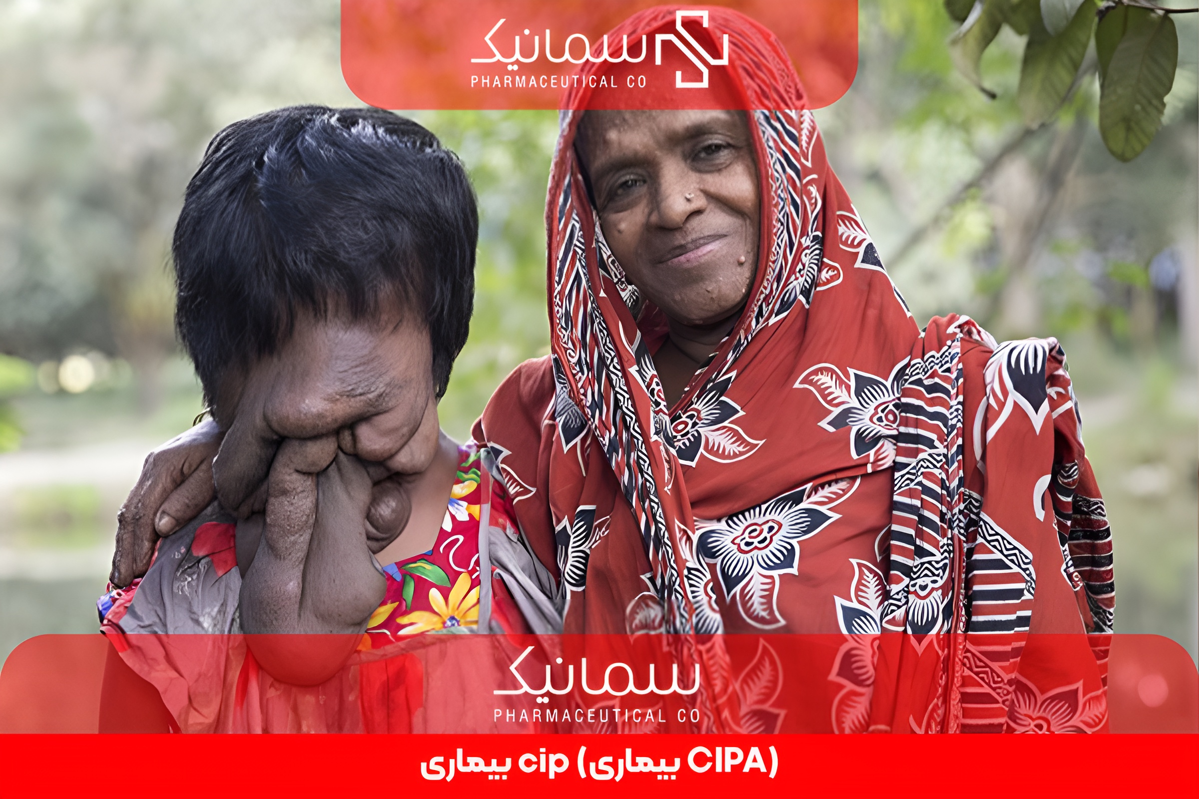 بیماری cip (بیماری CIPA)