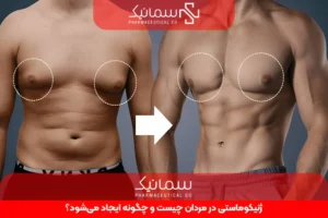 ژنیکوماستی در مردان چیست و چگونه ایجاد می‌شود؟