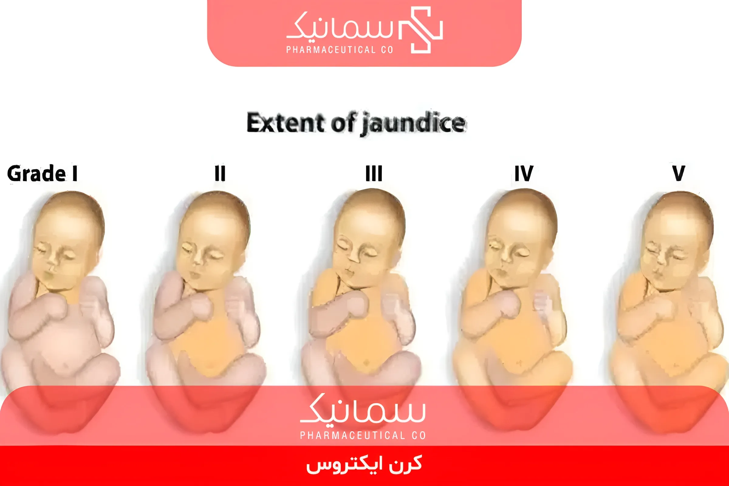 کرن ایکتروس