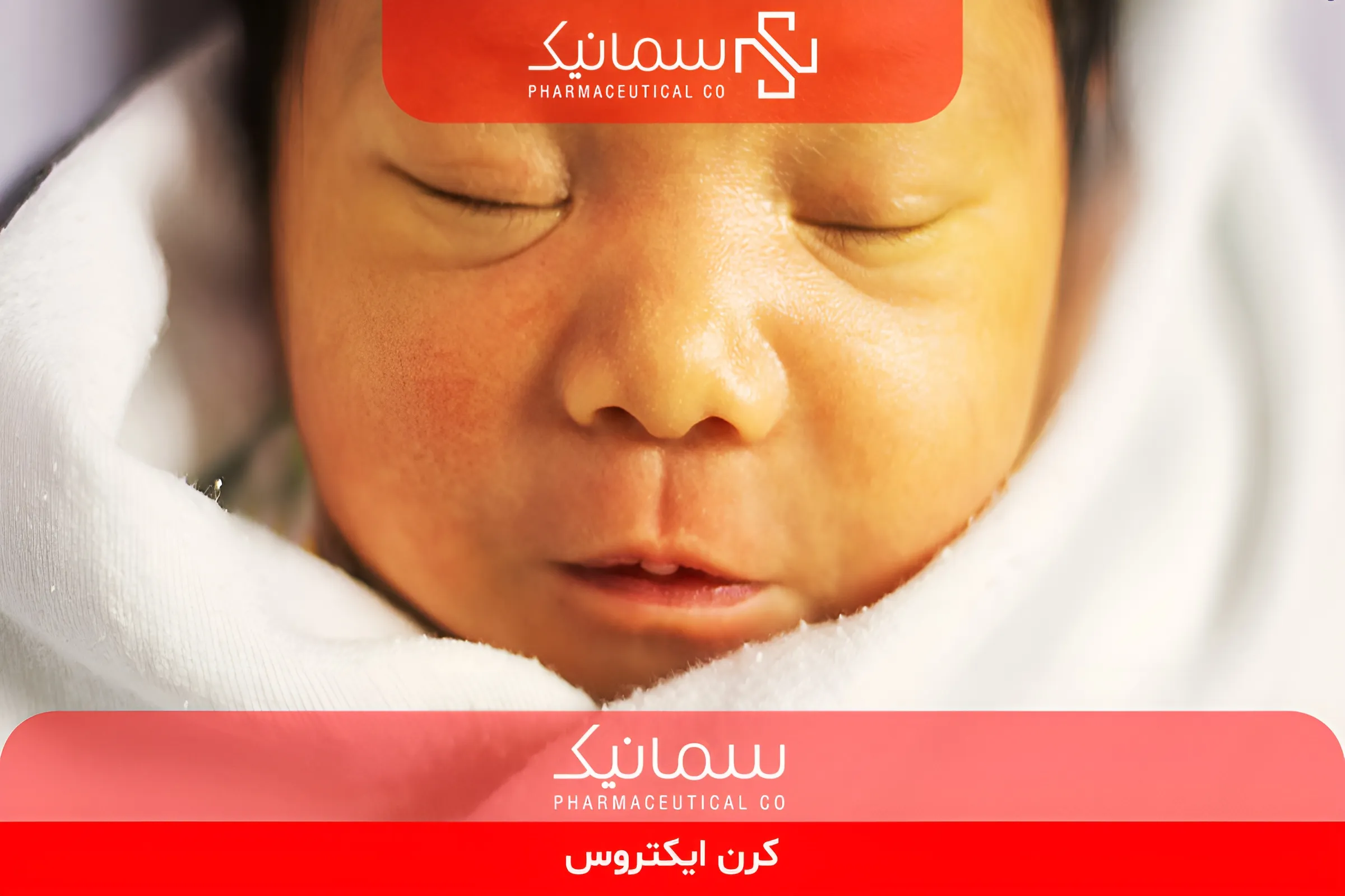 کرن ایکتروس