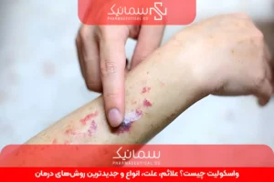واسکولیت چیست؟ علائم، علت، انواع و جدیدترین روش‌های درمان