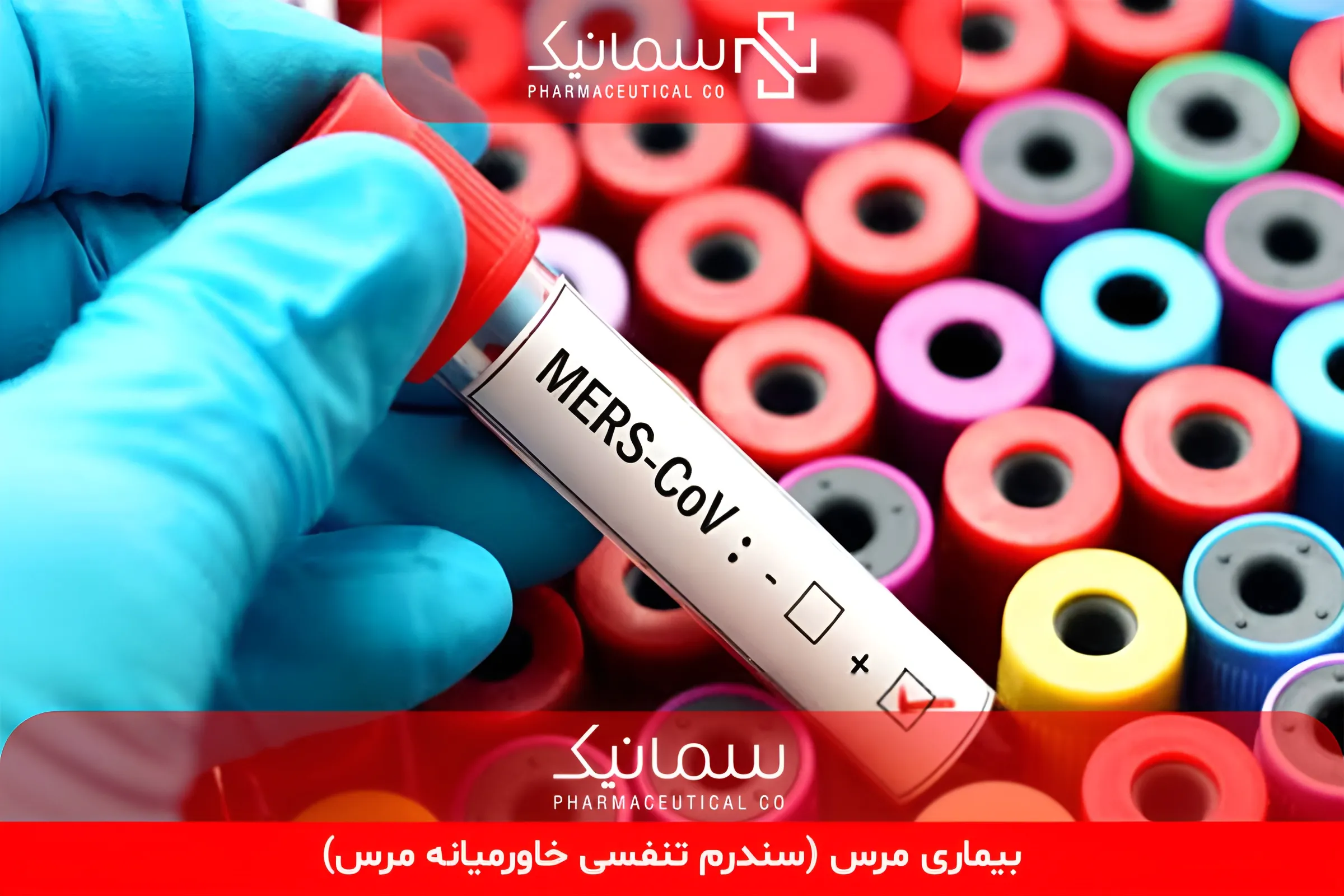 بیماری مرس (سندرم تنفسی خاورمیانه مرس)