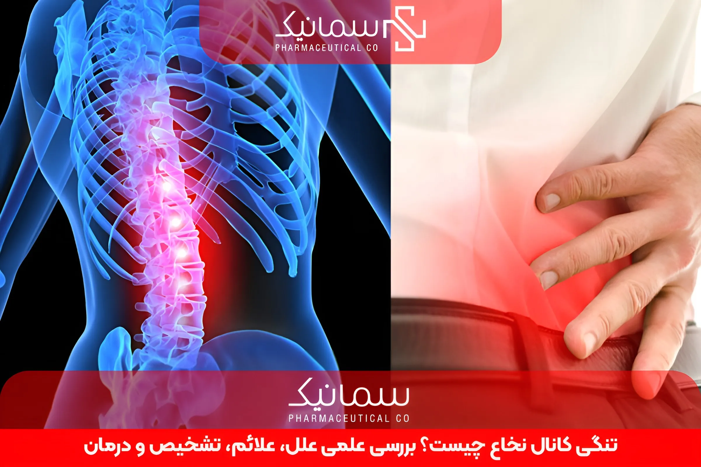 تنگی کانال نخاع چیست؟ بررسی علمی علل، علائم، تشخیص و درمان