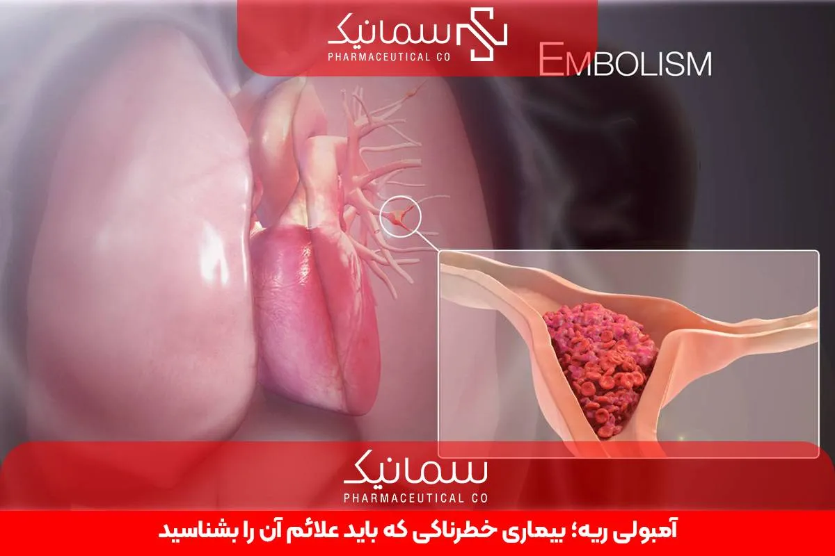 آمبولی ریه؛ بیماری خطرناکی که باید علائم آن را بشناسید