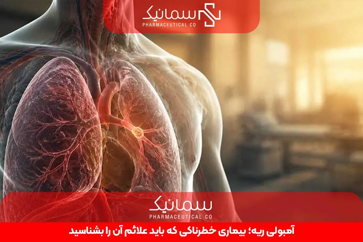 آمبولی ریه؛ بیماری خطرناکی که باید علائم آن را بشناسید