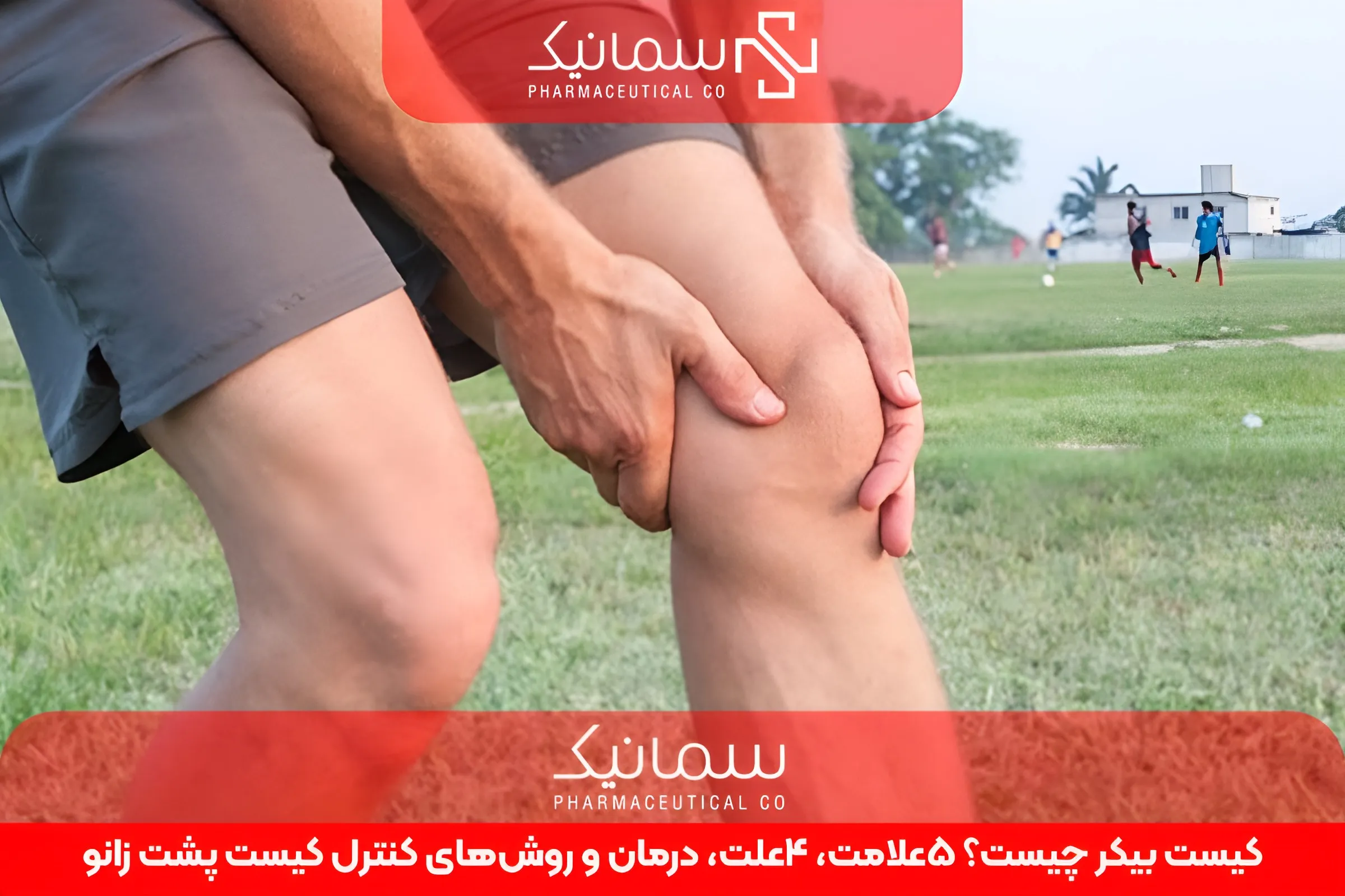 کیست بیکر چیست؟ 5علامت، 4علت، درمان و روش‌های کنترل کیست پشت زانو