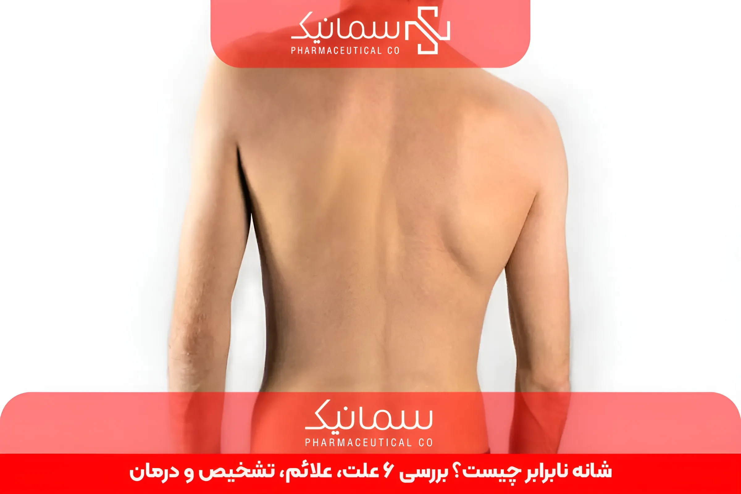 شانه نابرابر چیست؟ بررسی 6 علت، علائم، تشخیص و درمان