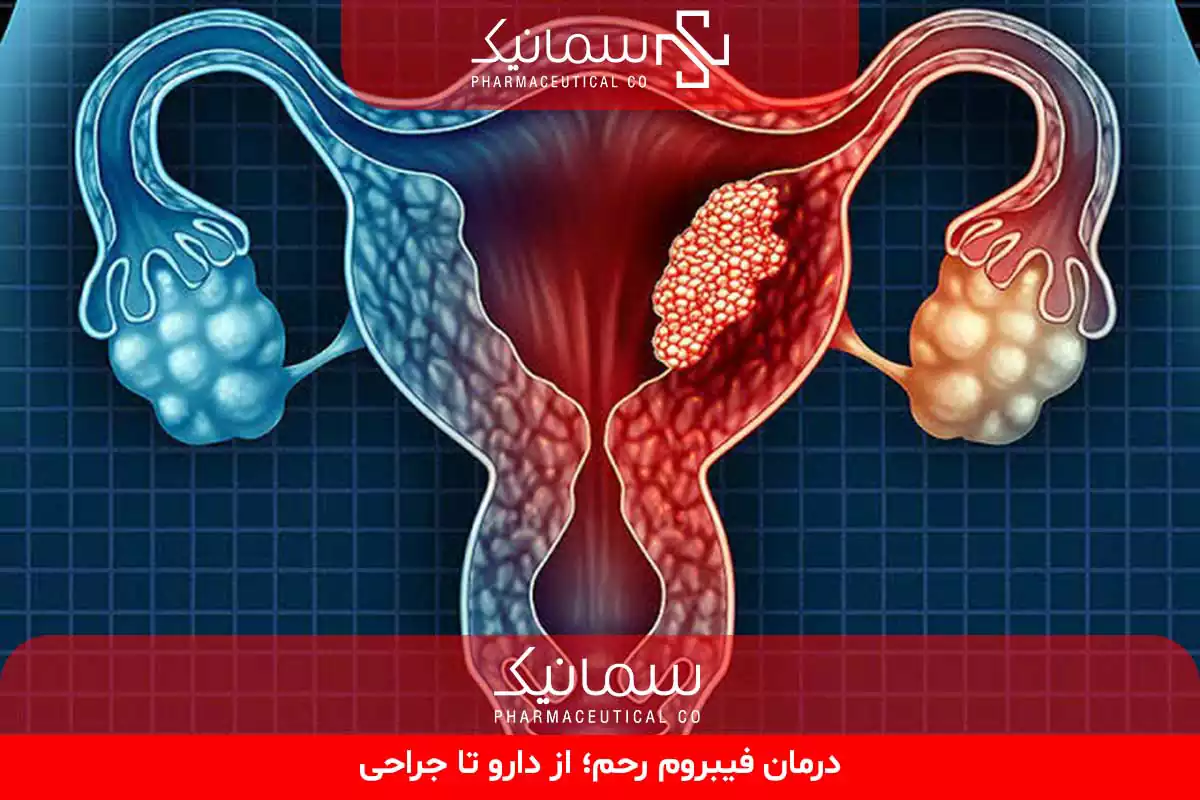 درمان فیبروم رحم
