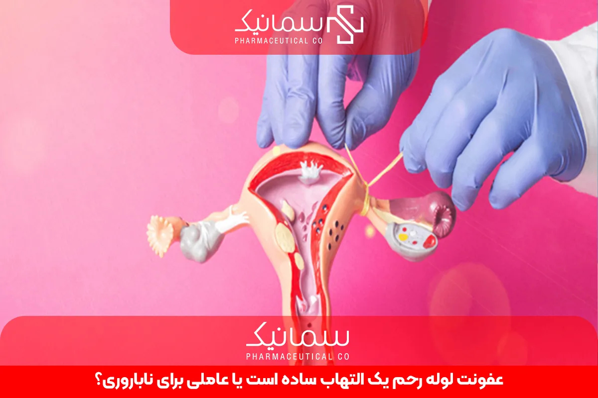 عفونت لوله رحم یک التهاب ساده است یا عاملی برای ناباروری؟