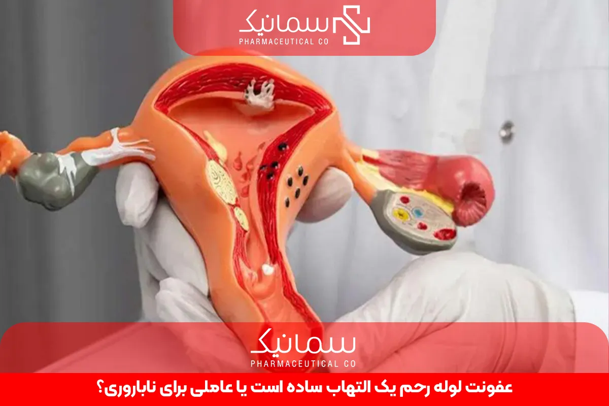 عفونت لوله رحم یک التهاب ساده است یا عاملی برای ناباروری؟