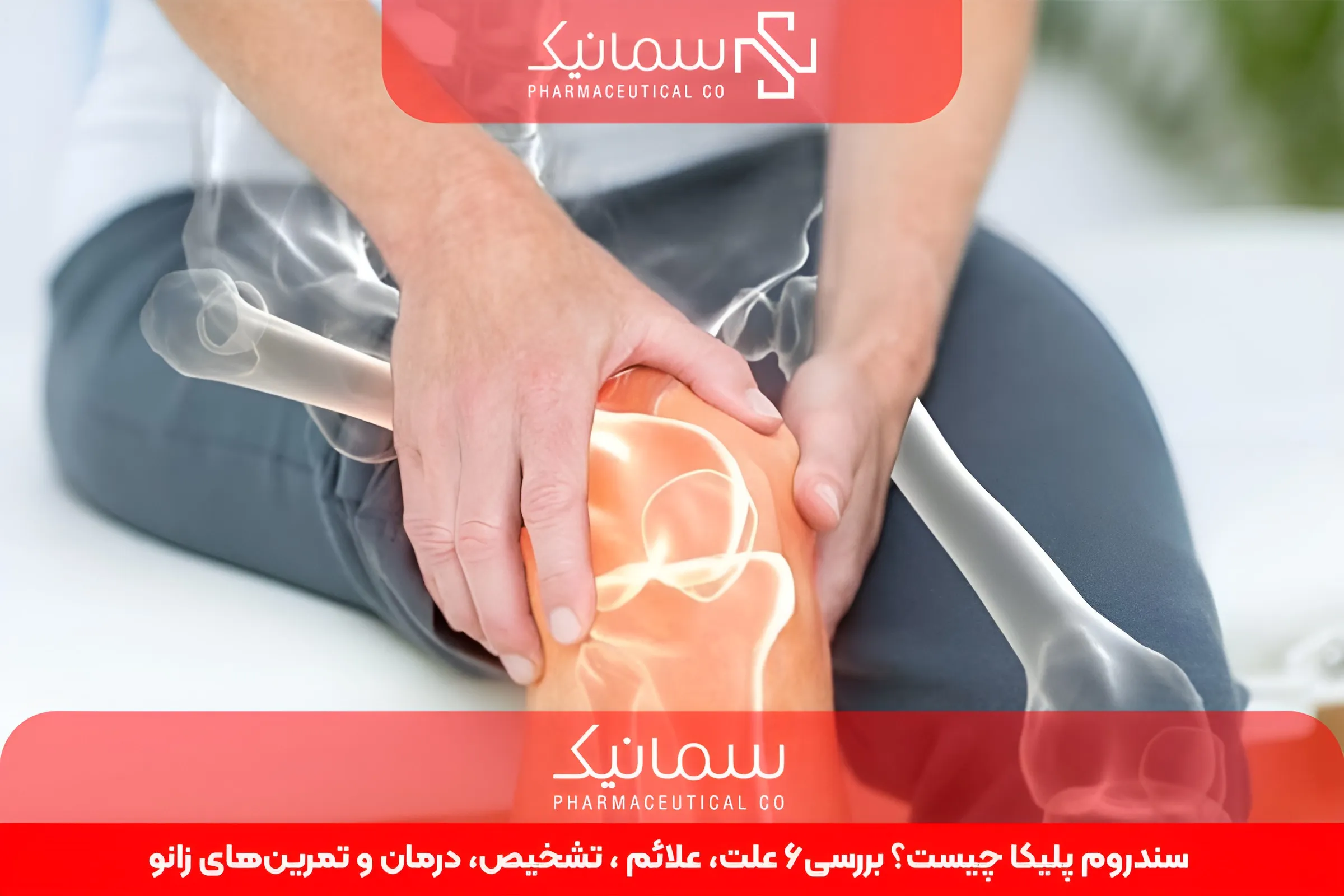 سندروم پلیکا چیست؟ بررسی6 علت، علائم ، تشخیص، درمان و تمرین‌های زانو