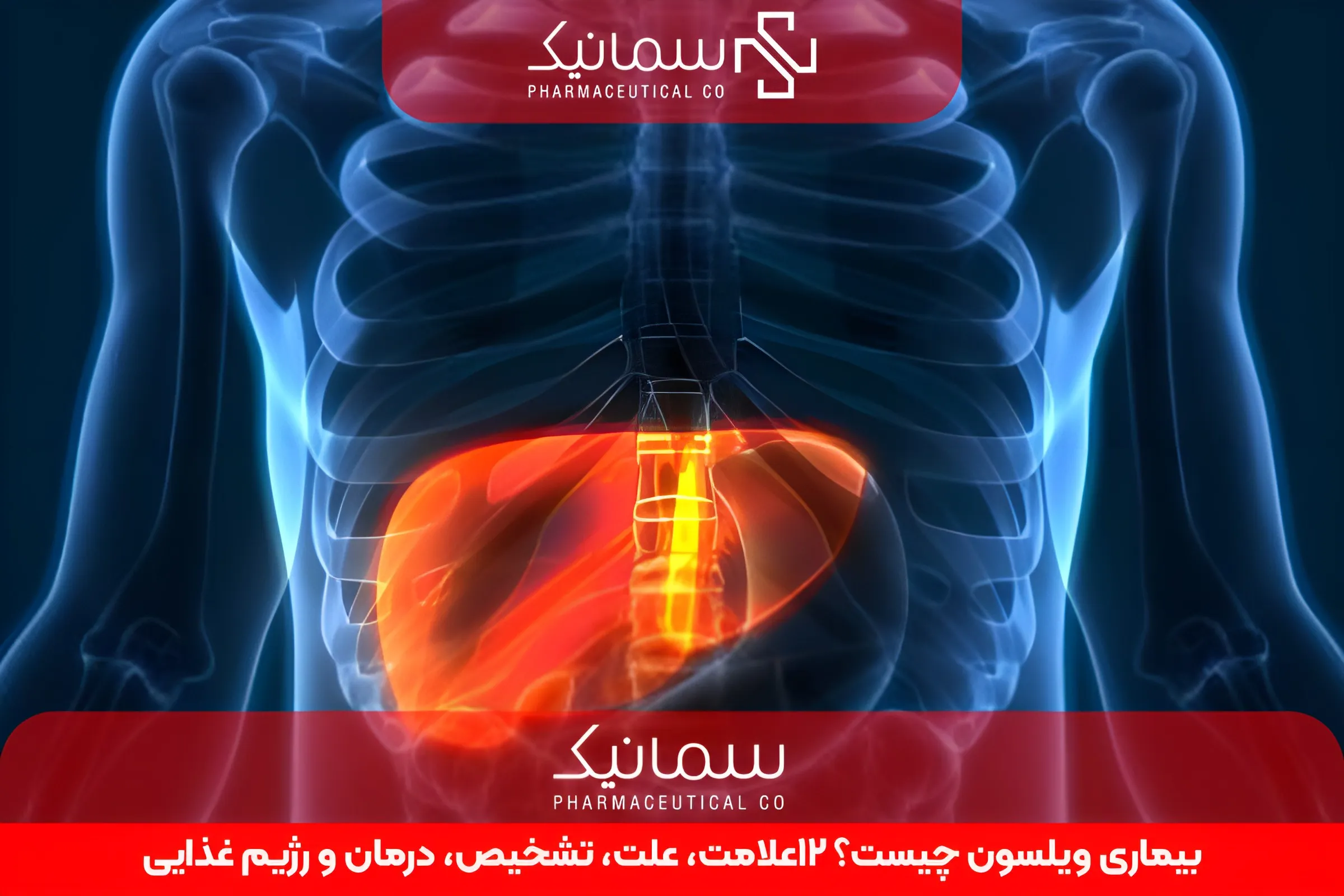 بیماری ویلسون چیست؟ 12علامت، علت، تشخیص، درمان و رژیم غذایی