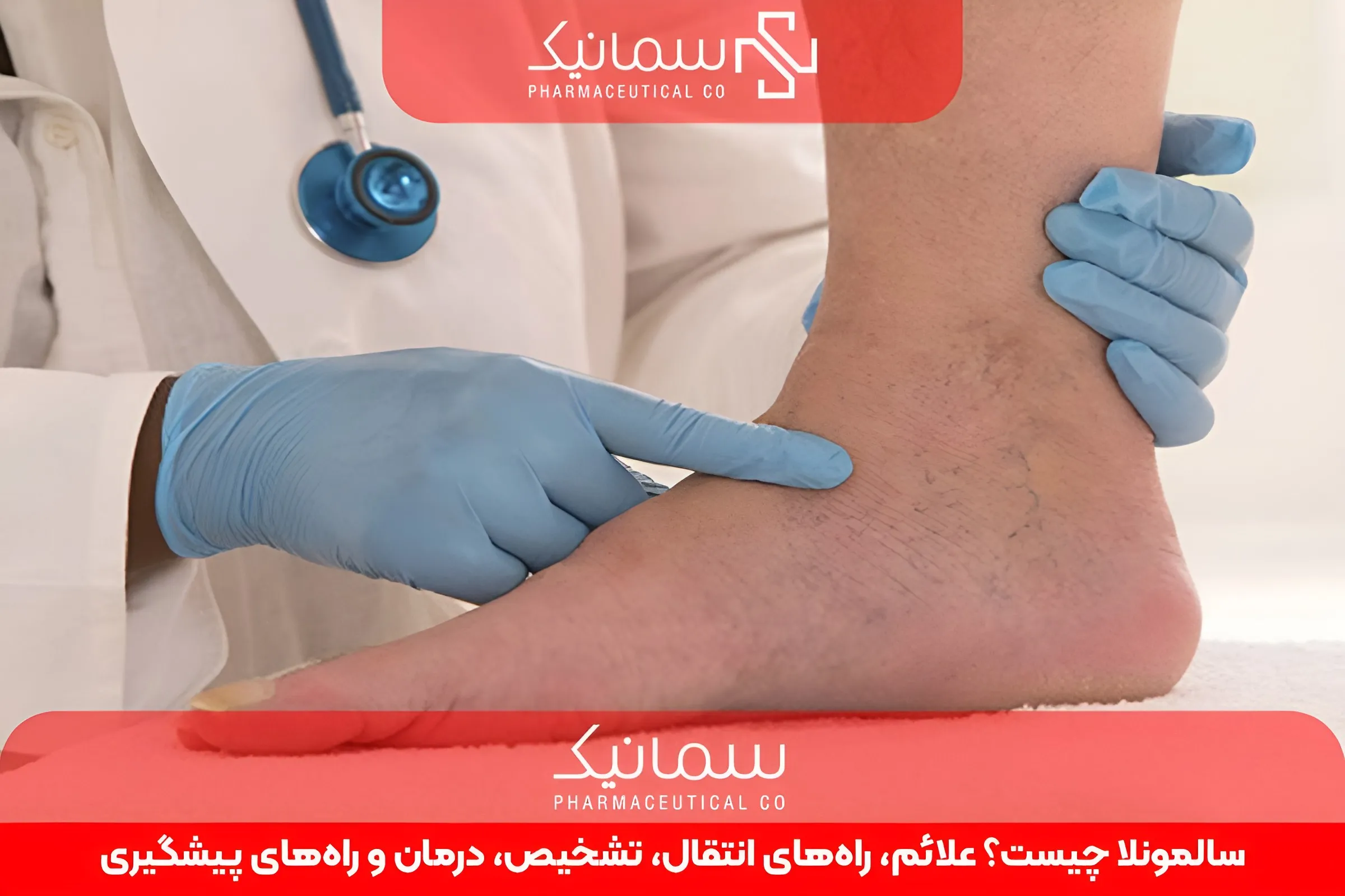 سالمونلا چیست؟ علائم، راه‌های انتقال، تشخیص، درمان و راه‌های پیشگیری