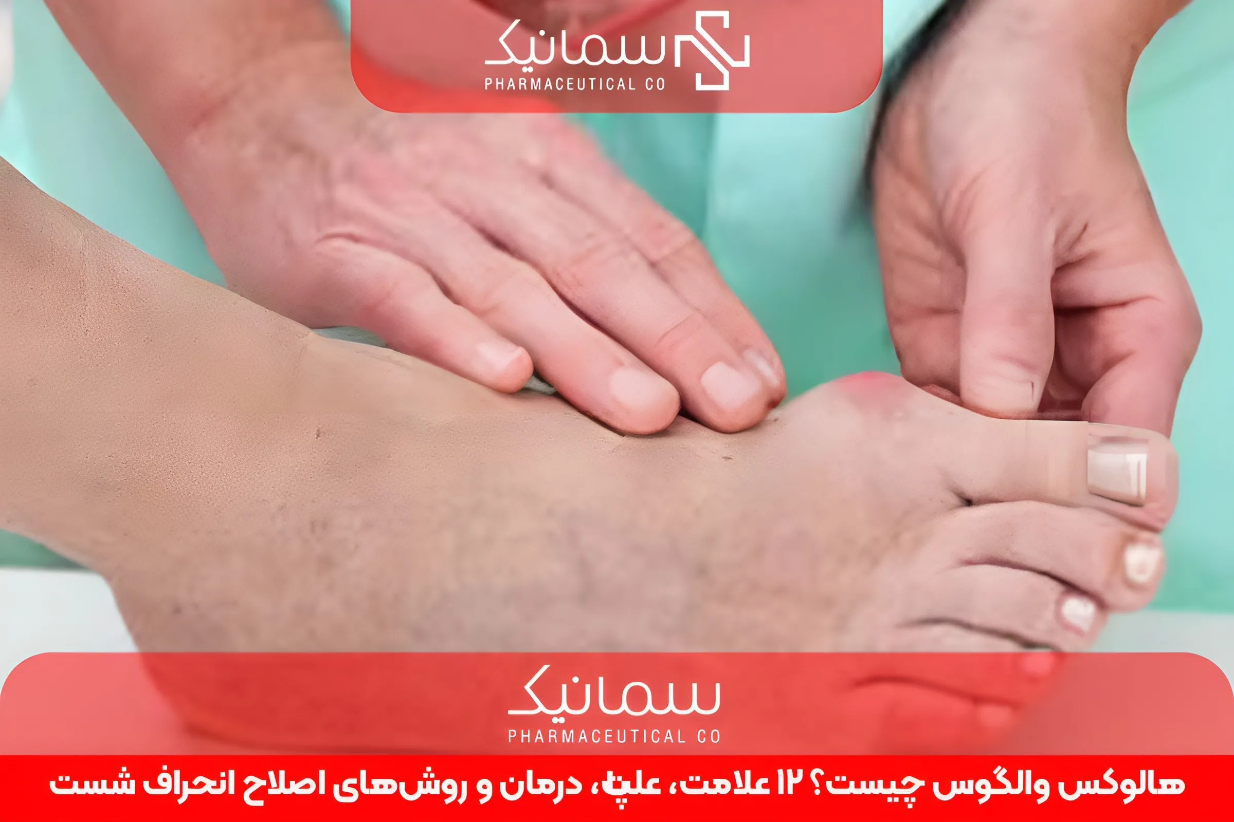 هالوکس والگوس چیست؟ ۱۲ علامت، علت، درمان و روش‌های اصلاح انحراف شست پا